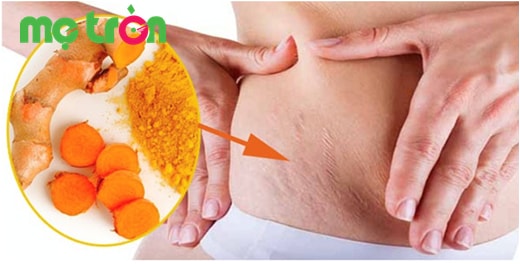 Giúp làm trắng da mang đến cho mẹ làn da mềm mịn sau sinh
