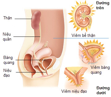 nhiem-trung-duong-tiet-nieu-khi-mang-thai.jpg (36 KB)